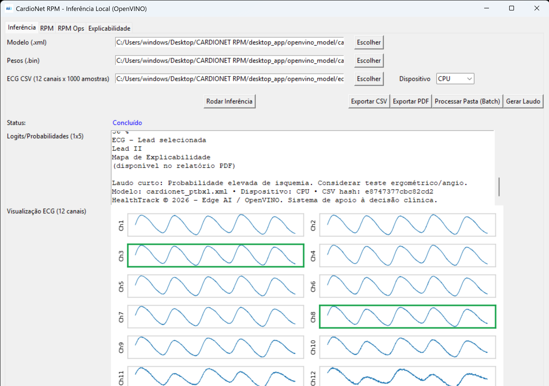 Tela de inferência (12 canais)