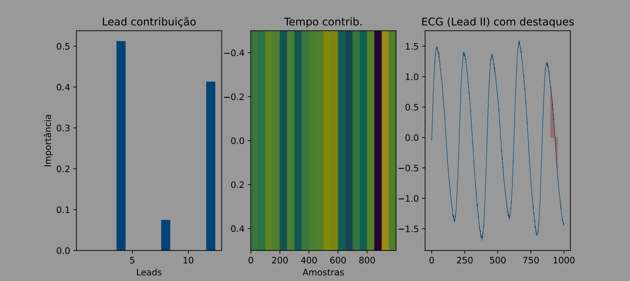 Lead contribuição / Mapa temporal / ECG com destaques